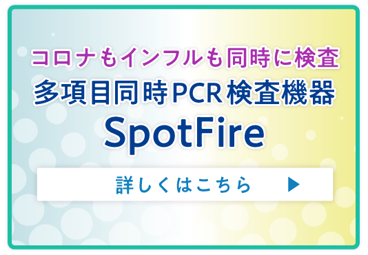 SpotFire(スポットファイア)